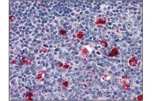 Immunohistochemistry (IHC) image for anti-Cathepsin D (CTSD) (AA 21-412) antibody (ABIN317502) (Cathepsin D antibody  (AA 21-412))