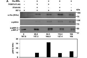 IFI44 decreases the kinase activity of IKKβ and IKKε. (IKKi/IKKe antibody  (pThr501))