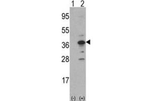 Western Blotting (WB) image for anti-DNA Segment, MCA1, Multiple CA Repeat 1 (MCA1) antibody (ABIN3002773) (MCA1 antibody)