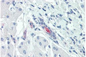 Anti-SLC5A1 / SGLT1 antibody  ABIN1049342 IHC staining of human liver. (SLC5A1 antibody  (Internal Region))