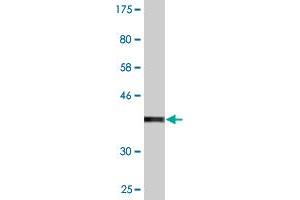 Western Blot detection against Immunogen (37. (SCYL3 antibody  (AA 553-660))