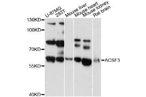 Western blot analysis of extracts of various cell lines, using ACSF3 antibody (ABIN6292804) at 1:3000 dilution. (ACSF3 antibody)