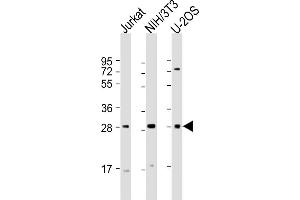 All lanes : Anti-SIX1 Antibody (Center) at 1:2000 dilution Lane 1: Jurkat whole cell lysate Lane 2: NIH/3T3 whole cell lysate Lane 3: U-2OS whole cell lysate Lysates/proteins at 20 μg per lane. (SIX Homeobox 1 antibody  (AA 69-102))
