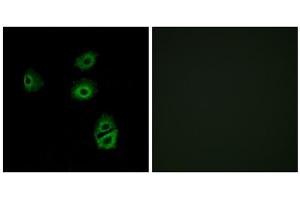 Immunofluorescence analysis of A549 cells, using OR2B2 antibody. (OR2B2 antibody  (Internal Region))