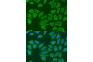Immunofluorescence analysis of U2OS cells using  antibody (ABIN6131173, ABIN6136581, ABIN6136582 and ABIN6223850) at dilution of 1:100. (ADH7 antibody  (AA 1-386))