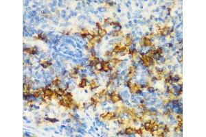 Immunohistochemistry of paraffin-embedded Rat spleen using CD3D Polyclonal Antibody at dilution of 1:200 (40x lens). (CD3D antibody)