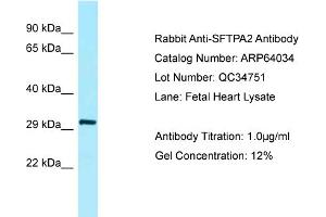 Western Blotting (WB) image for anti-Surfactant Associated Protein A2 (SFTPA2) (N-Term) antibody (ABIN2789704) (SFTPA2 antibody  (N-Term))