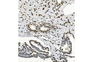 IHC analysis of HP1 alpha/CBX5 using anti-HP1 alpha/CBX5 antibody (ABIN7599058). (CBX5 antibody  (AA 1-191))