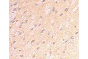 Immunohistochemical staining of rat brain using AP30071PU-N APP antibody at 2 μg/ml.