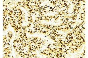 ABIN6277126 at 1/100 staining Human lung tissue by IHC-P. (MALT1 antibody  (Internal Region))