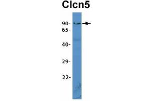Western Blotting (WB) image for anti-Chloride Channel 5 (CLCN5) (Middle Region) antibody (ABIN2776081)