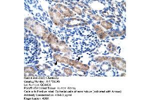 Human kidney (CLIC1 antibody  (N-Term))