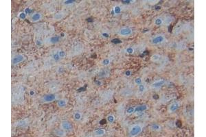 IHC-P analysis of Rat Cerebrum Tissue, with DAB staining. (S100B antibody  (AA 1-92))