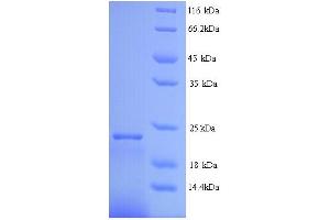 SDS-PAGE (SDS) image for Interferon, alpha 2 (IFNA2) (AA 24-188) protein (His tag) (ABIN5714192) (IFNA2 Protein (AA 24-188) (His tag))