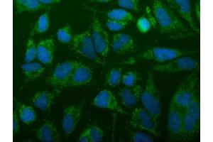 IF analysis of FIS1 using anti-FIS1 antibody (ABIN7598965).
