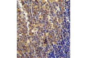 Immunohistochemistry analysis in formalin fixed and paraffin embedded human tonsil tissue reacted with LYRM4 Antibody (Center) followed which was peroxidase conjugated to the secondary antibody and followed by DAB staining. (LYRM4 antibody  (Middle Region))