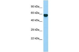 Host: Rabbit Target Name: SYT14 Sample Type: Fetal Brain lysates Antibody Dilution: 1. (SYT14 antibody  (Middle Region))