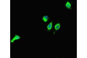 Immunofluorescent analysis of Hela cells using ABIN7160851 at dilution of 1:100 and Alexa Fluor 488-congugated AffiniPure Goat Anti-Rabbit IgG(H+L) (SIRT1 antibody  (AA 2-747))