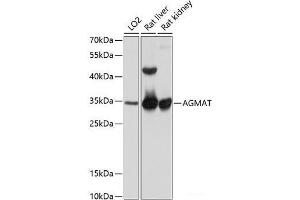Western blot analysis of extracts of various cell lines using AGMAT Polyclonal Antibody at dilution of 1:1000. (AGMAT antibody)
