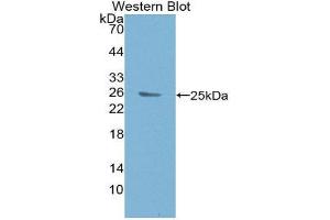 Western Blotting (WB) image for anti-B-Cell CLL/lymphoma 9 (BCL9) (AA 1119-1328) antibody (ABIN3201061) (BCL9 antibody  (AA 1119-1328))