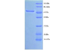 ABL1 Protein (AA 4-194, partial) (GST tag)