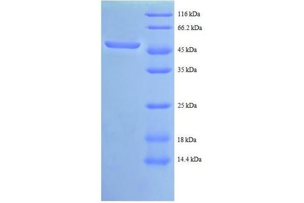 ABL1 Protein (AA 4-194, partial) (GST tag)