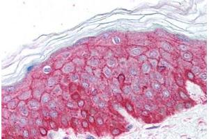 Human Skin (formalin-fixed, paraffin-embedded) stained with ACTB antibody ABIN213653 at 5 ug/ml followed by biotinylated goat anti-rabbit IgG secondary antibody ABIN481713, alkaline phosphatase-streptavidin and chromogen. (beta Actin antibody  (C-Term))