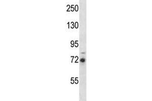 RIPK1 antibody western blot analysis in MDA-MB231 lysate. (RIPK1 antibody  (AA 152-180))