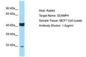 Image no. 1 for anti-Secretory Carrier Membrane Protein 4 (SCAMP4) (AA 41-90) antibody (ABIN6750134) (SCAMP4 antibody  (AA 41-90))
