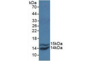 Western blot analysis of recombinant Simian MCP1. (CCL2 antibody  (AA 24-99))