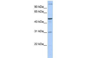 WB Suggested Anti-ACBD5 Antibody Titration:  0. (ACBD5 antibody  (N-Term))