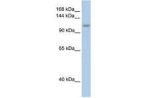 PRPF6 antibody used at 2. (PRP6/ANT-1 antibody)