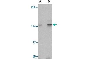 Western blot analysis of KIF5A in K-562 cell lysate with KIF5A polyclonal antibody  at (A) 0. (KIF5A antibody  (AA 330-380))