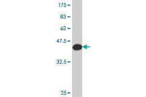 Western Blot detection against Immunogen (37. (PHIP antibody  (AA 1599-1705))