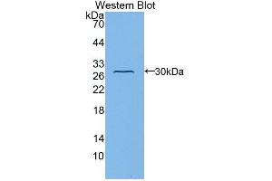 Western blot analysis of the recombinant protein. (Fibulin 1 antibody  (AA 176-398))