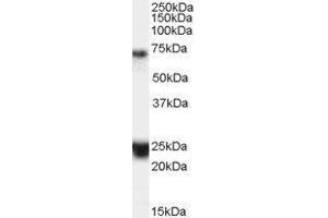 Western Blotting (WB) image for Huntingtin Associated Protein 1 (HAP1) peptide (ABIN369602) (Huntingtin Associated Protein 1 (HAP1) Peptide)