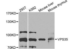 Western blot analysis of extracts of various cell lines, using VPS35 antibody.