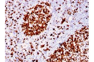Immunohistochemistry (IHC) image for anti-Minichromosome Maintenance Complex Component 6 (MCM6) (AA 228-368) antibody (ABIN6940016)
