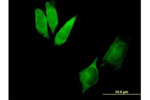 Immunofluorescence of purified MaxPab antibody to DYNC1I2 on HeLa cell. (DYNC1I2 antibody  (AA 1-612))