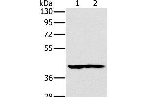 Western Blot analysis of Mouse heart and kidney tissue using NDUFA10 Polyclonal Antibody at dilution of 1:450 (NDUFA10 antibody)