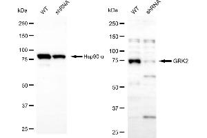 Western blotting analysis using GRK2 antibody (ABIN7797537).