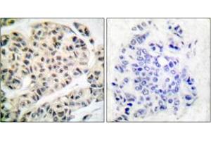 Immunohistochemistry (IHC) image for anti-Myocyte Enhancer Factor 2A (MEF2A) (AA 296-345), (pThr319) antibody (ABIN1531901)