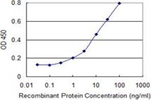 Detection limit for recombinant GST tagged ULK2 is 0. (ULK2 antibody  (AA 743-843))