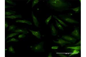 Immunofluorescence of monoclonal antibody to NMNAT2 on HeLa cell. (NMNAT2 antibody  (AA 1-302))