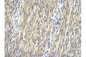 Immunohistochemistry (IHC) image for anti-Checkpoint Kinase 1 (CHEK1) (Middle Region) antibody (ABIN2779737)