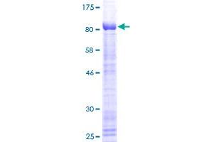 Image no. 1 for Kruppel-Like Factor 4 (Gut) (KLF4) (AA 1-470) protein (GST tag) (ABIN1308754) (KLF4 Protein (AA 1-470) (GST tag))