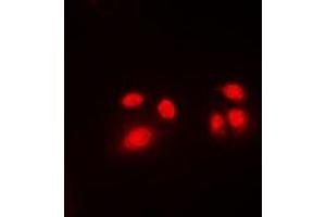 Immunofluorescent analysis of CBFB staining in Jurkat cells.