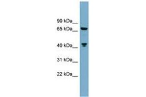 Image no. 1 for anti-Glutaminase (GLS) (C-Term) antibody (ABIN6743797) (Glutaminase antibody  (C-Term))