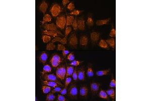 Immunofluorescence analysis of HeLa cells using SYNE3 Rabbit pAb (ABIN6131129, ABIN6148766, ABIN6148767 and ABIN6217163) at dilution of 1:100. (Nesprin3 antibody  (AA 740-920))