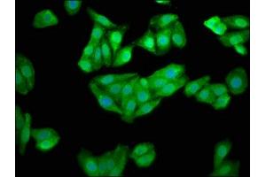 Immunofluorescence staining of HepG2 cells with ABIN7147628 at 1:100, counter-stained with DAPI.